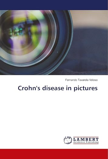 Crohn's Disease in Pictures