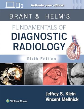 [9781975199005] Brant & Helms' Fundamentals of Diagnostic Radiology: Print + eBook with Multimedia 
