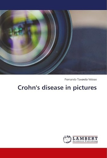 [9786137342305] Crohn's Disease in Pictures
