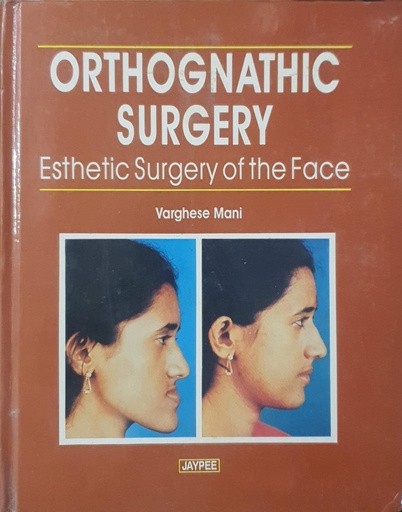 [9788171794157] Orthognathic Surgery Esthetic Surgery of the Face